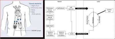 Echocardiographic imaging and ventricular mechanics in pulsatile-flow LVAD pediatric patients: a systematic approach